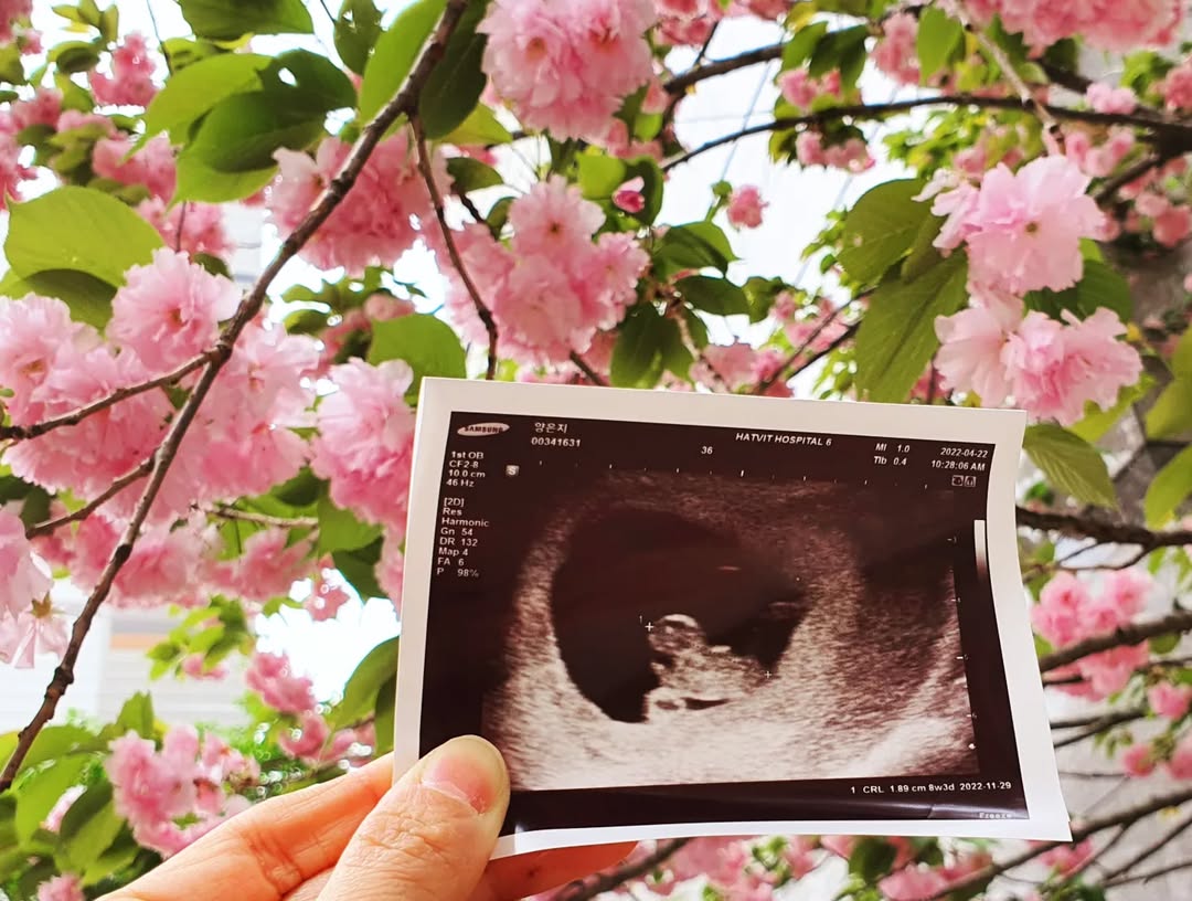 코로나19 극복하고 찾아온 세 번째 기적: 늦둥이 '짹짹이' 임밍아웃 스토리!